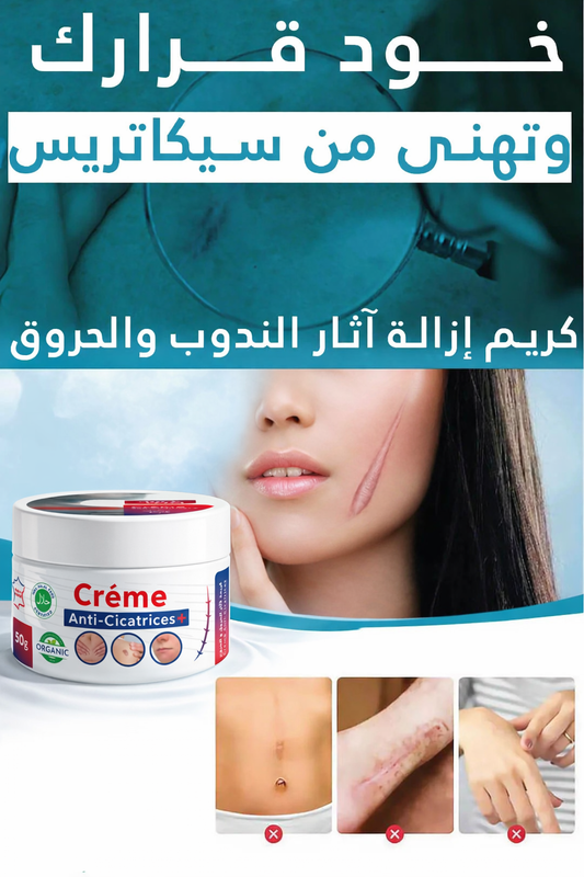 Creme Cicatrisse - كريم سيكاتريس الأصلي
